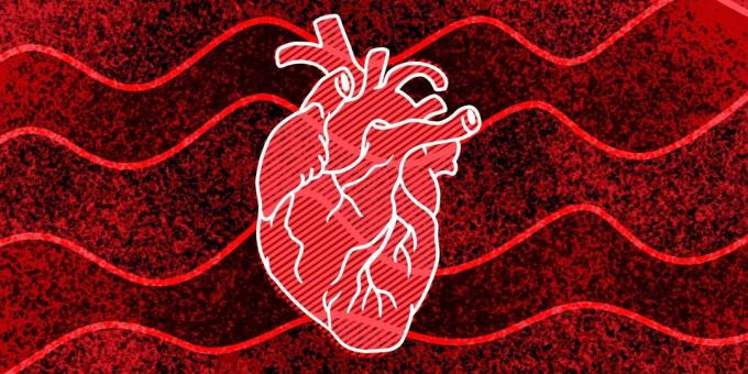 11 علامات أنك قد يحدث توقف القلب