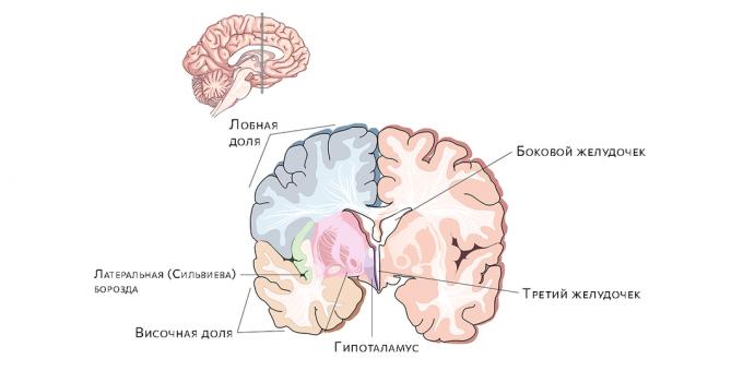 بطينات الدماغ. يؤدي تراكم السوائل فيها إلى استسقاء الرأس.