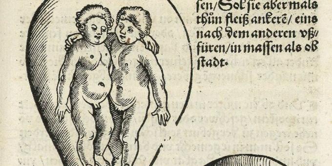 أطفال العصور الوسطى: توأمان في الرحم ، يوكاريوس روديون