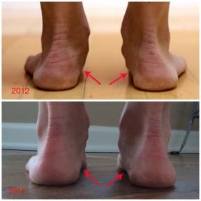 كيفية تشغيل في الأحذية الحد الأدنى تغير قدم