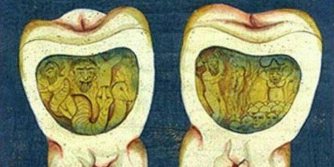طب العصور الوسطى: صفحة من أطروحة الأسنان العثمانية ، القرن السابع عشر.
